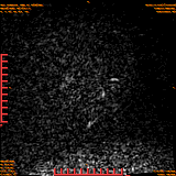 2026-04-15/Brain/AAHead Scout/0008-.png