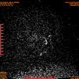 2026-04-15/Brain/AAHead Scout/0009-.png