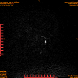 2026-04-15/Brain/AAHead Scout/0010-.png