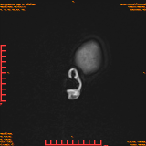 2026-04-15/Brain/AAHead Scout/0023-.png