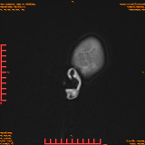2026-04-15/Brain/AAHead Scout/0024-.png