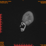 2026-04-15/Brain/AAHead Scout/0025-.png