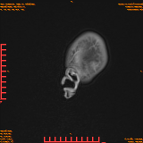 2026-04-15/Brain/AAHead Scout/0026-.png