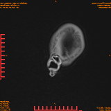 2026-04-15/Brain/AAHead Scout/0027-.png