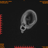2026-04-15/Brain/AAHead Scout/0028-.png