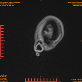 2026-04-15/Brain/AAHead Scout/0029-.png