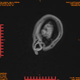 2026-04-15/Brain/AAHead Scout/0030-.png