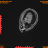 2026-04-15/Brain/AAHead Scout/0031-.png