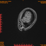 2026-04-15/Brain/AAHead Scout/0032-.png