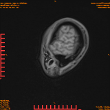 2026-04-15/Brain/AAHead Scout/0033-.png