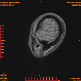 2026-04-15/Brain/AAHead Scout/0034-.png