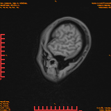 2026-04-15/Brain/AAHead Scout/0035-.png