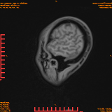 2026-04-15/Brain/AAHead Scout/0036-.png