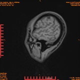 2026-04-15/Brain/AAHead Scout/0037-.png