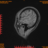 2026-04-15/Brain/AAHead Scout/0038-.png