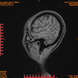 2026-04-15/Brain/AAHead Scout/0039-.png