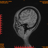2026-04-15/Brain/AAHead Scout/0040-.png