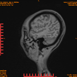 2026-04-15/Brain/AAHead Scout/0041-.png