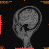 2026-04-15/Brain/AAHead Scout/0042-.png