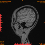 2026-04-15/Brain/AAHead Scout/0043-.png