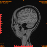2026-04-15/Brain/AAHead Scout/0044-.png