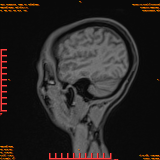 2026-04-15/Brain/AAHead Scout/0045-.png