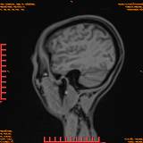 2026-04-15/Brain/AAHead Scout/0046-.png