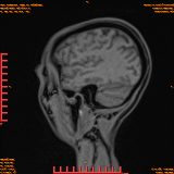 2026-04-15/Brain/AAHead Scout/0047-.png