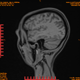 2026-04-15/Brain/AAHead Scout/0048-.png
