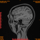 2026-04-15/Brain/AAHead Scout/0049-.png