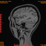 2026-04-15/Brain/AAHead Scout/0050-.png