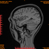 2026-04-15/Brain/AAHead Scout/0052-.png