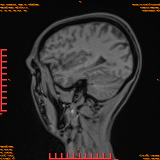 2026-04-15/Brain/AAHead Scout/0053-.png
