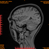 2026-04-15/Brain/AAHead Scout/0054-.png