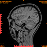 2026-04-15/Brain/AAHead Scout/0055-.png