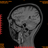 2026-04-15/Brain/AAHead Scout/0056-.png