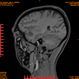 2026-04-15/Brain/AAHead Scout/0057-.png