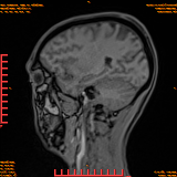 2026-04-15/Brain/AAHead Scout/0058-.png