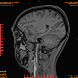 2026-04-15/Brain/AAHead Scout/0059-.png