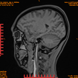 2026-04-15/Brain/AAHead Scout/0060-.png