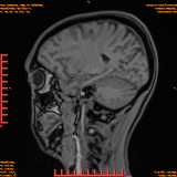 2026-04-15/Brain/AAHead Scout/0061-.png