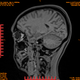 2026-04-15/Brain/AAHead Scout/0062-.png