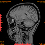 2026-04-15/Brain/AAHead Scout/0063-.png
