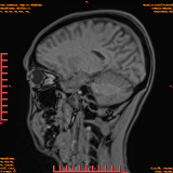 2026-04-15/Brain/AAHead Scout/0064-.png