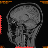 2026-04-15/Brain/AAHead Scout/0065-.png