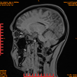 2026-04-15/Brain/AAHead Scout/0067-.png