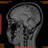 2026-04-15/Brain/AAHead Scout/0068-.png