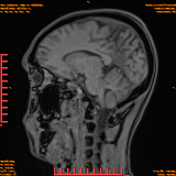 2026-04-15/Brain/AAHead Scout/0069-.png