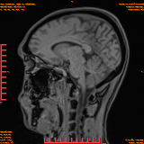 2026-04-15/Brain/AAHead Scout/0070-.png