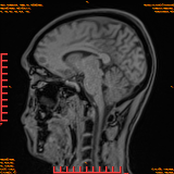 2026-04-15/Brain/AAHead Scout/0071-.png